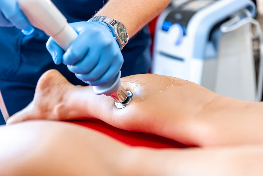 Radiale Stoßwellentherapie